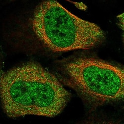 LIM kinase 2 Antibody, Novus Biologicals:Antibodies:Primary Antibodies